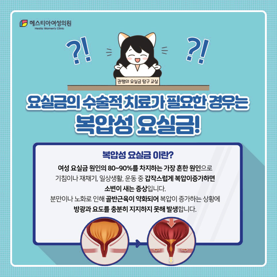 요실금수술비용
요실금수술가격