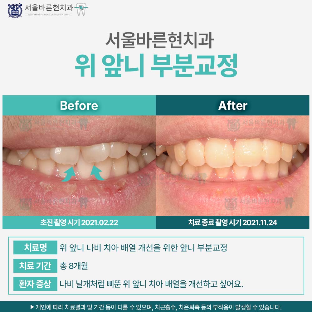 마린시티교정치과