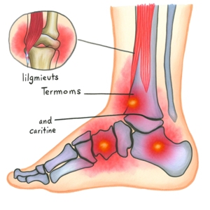 발목이 아플 때