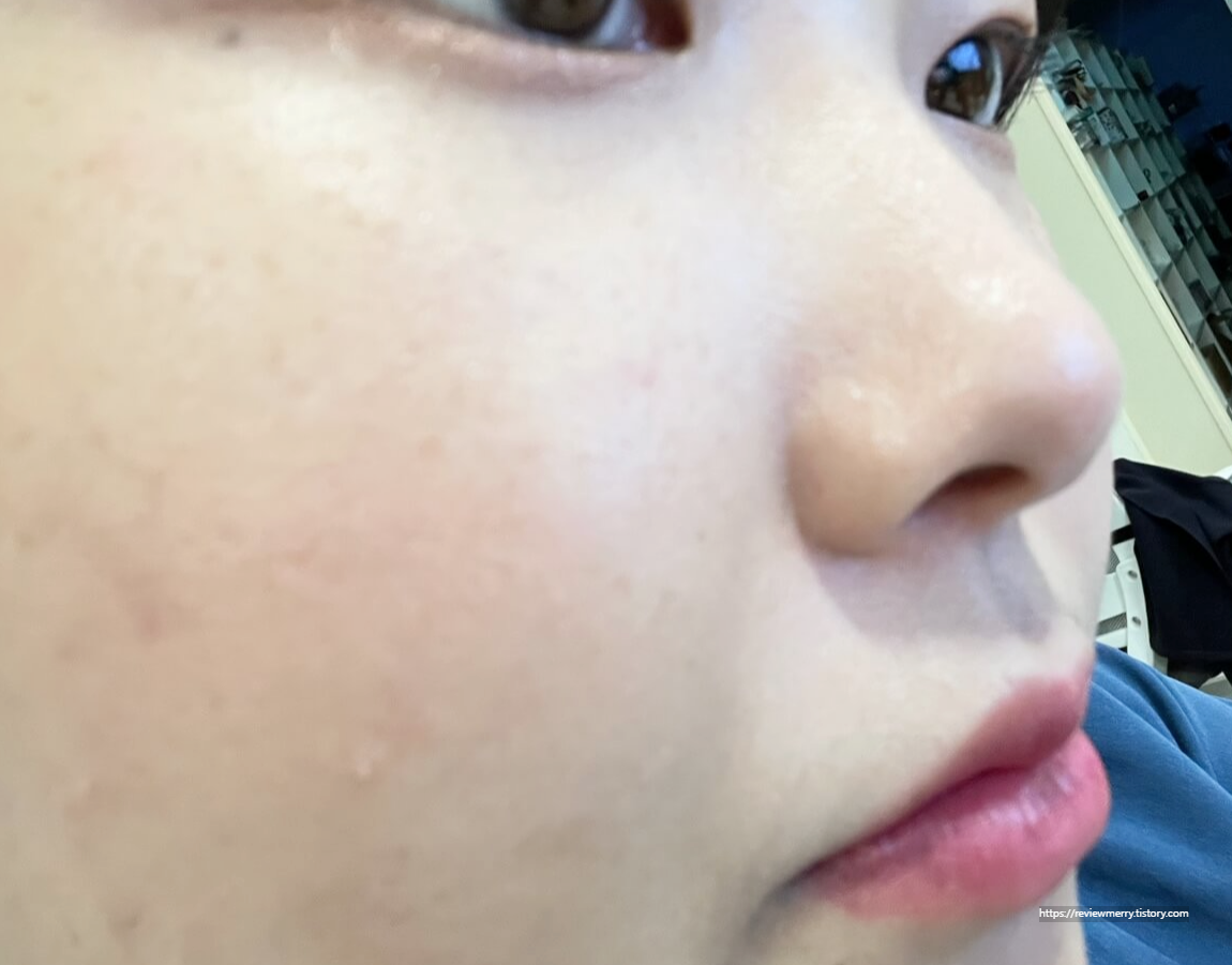 10시간 후 볼, 코옆 사진