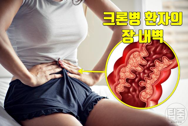 크론병 증상 복부통증 배가 꼬이는 느낌