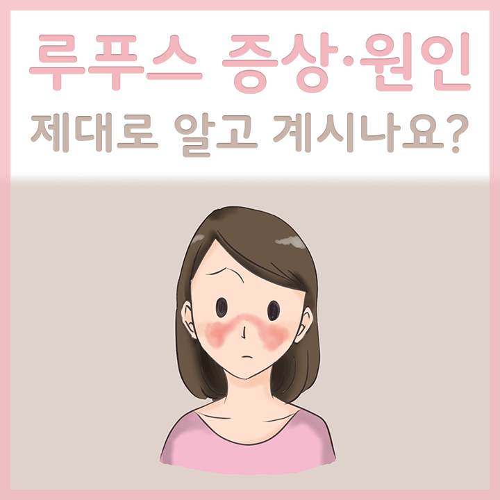 루푸스가-있는-여성