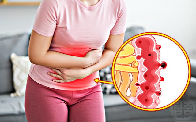 위석 분석 장에도 결석