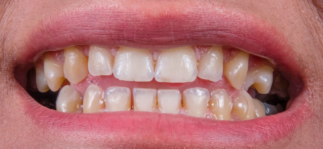implant