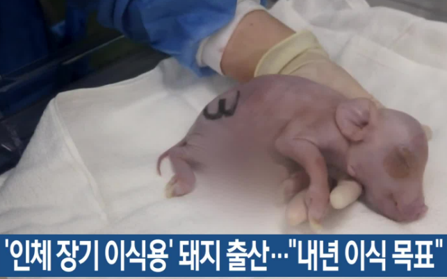 돼지를 이용한 이종이식