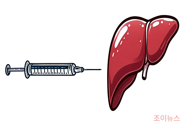 간암 진단 방법 - 조직(생검)검사