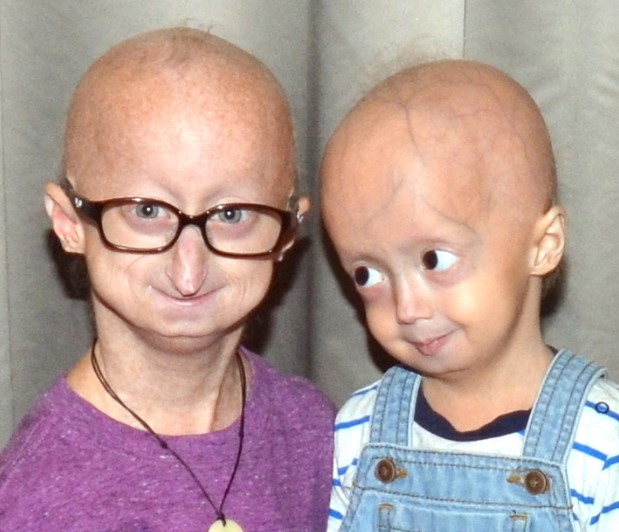 소아조로증 치료방법