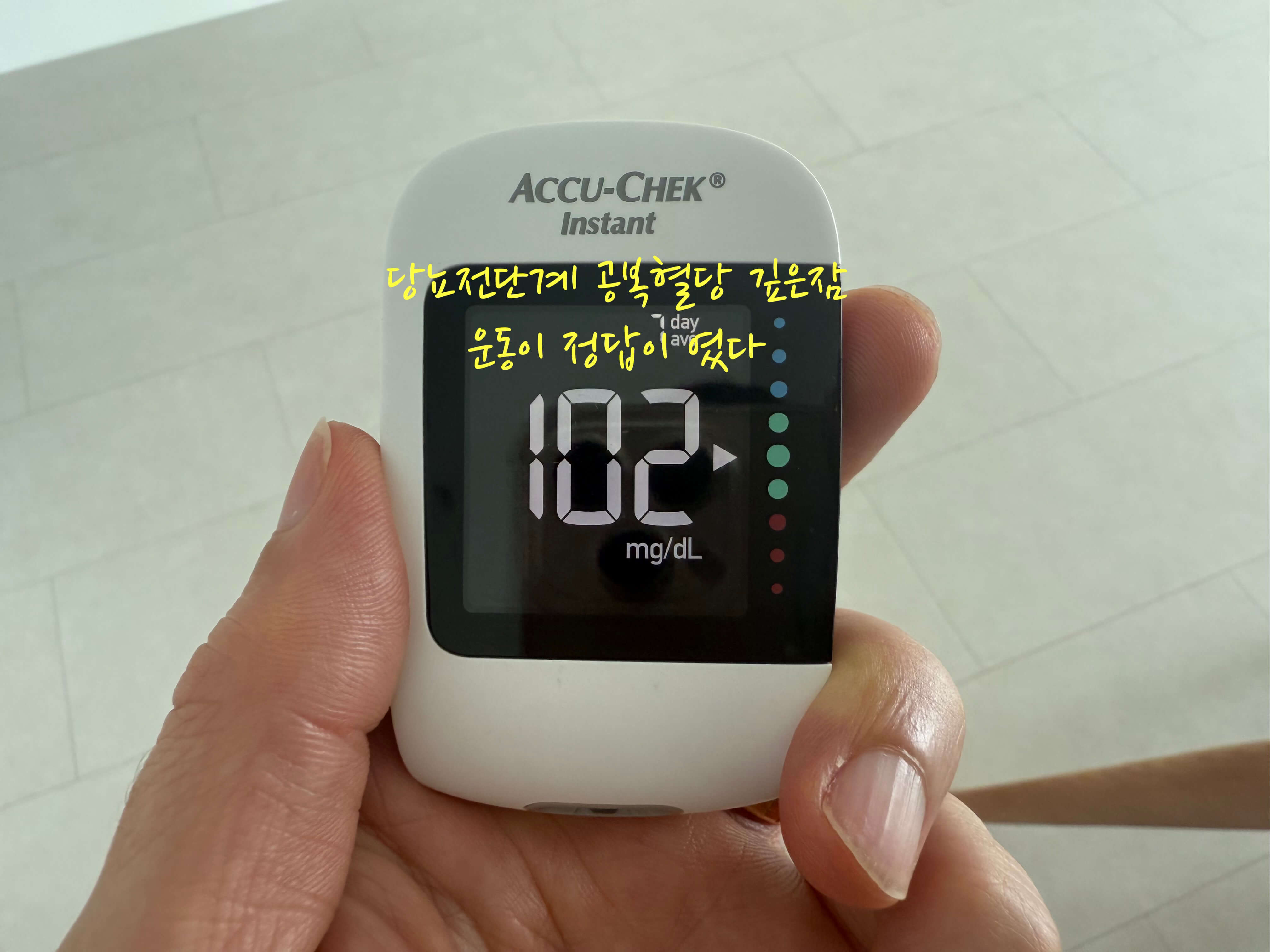 당뇨 전단계 관리