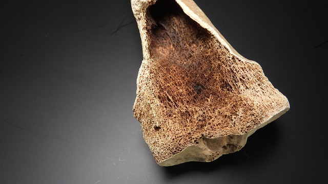 구멍이 듬성듬성 난 뼈의 사진