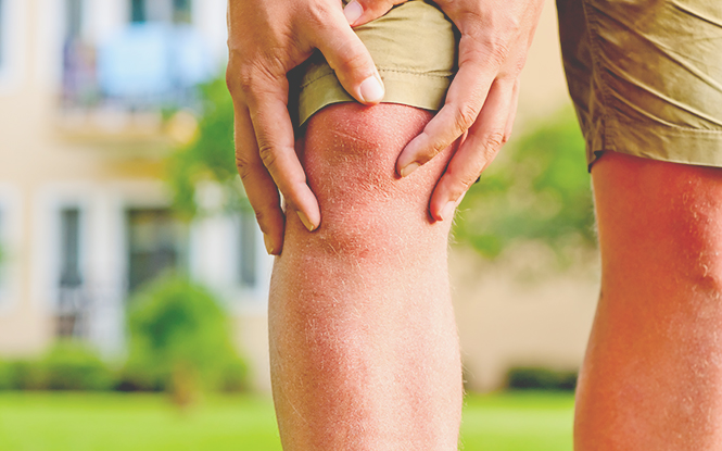 퇴행성 관절염 증상