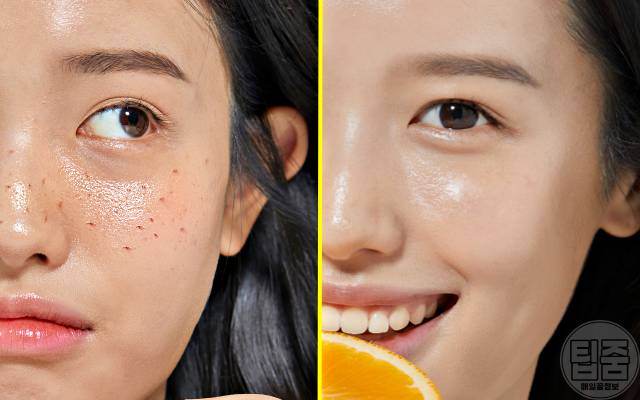 기미 제거 음식 천연 기미치료제 식품