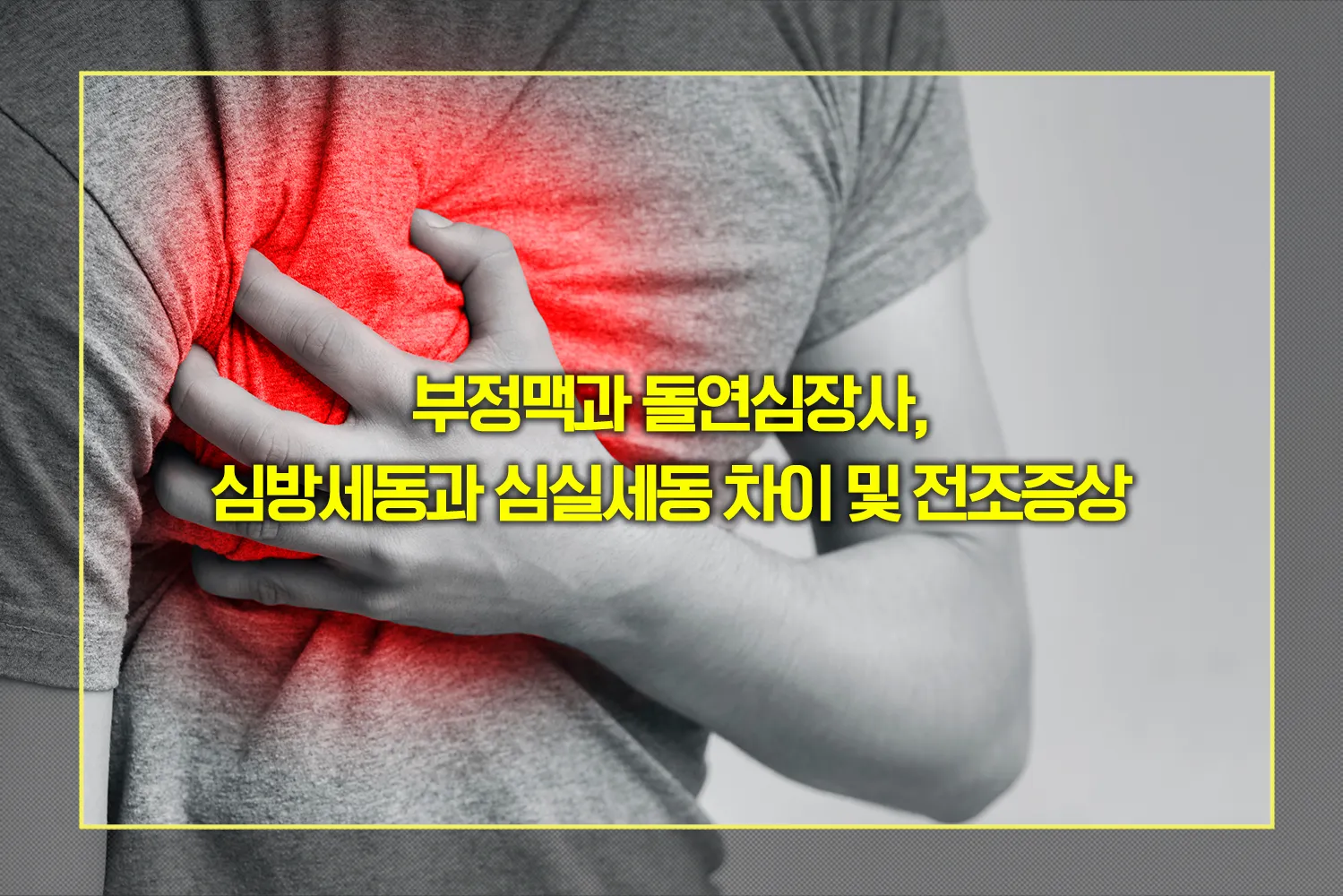 부정맥-심방세동-심실세동-돌연사-예방