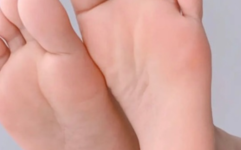 발