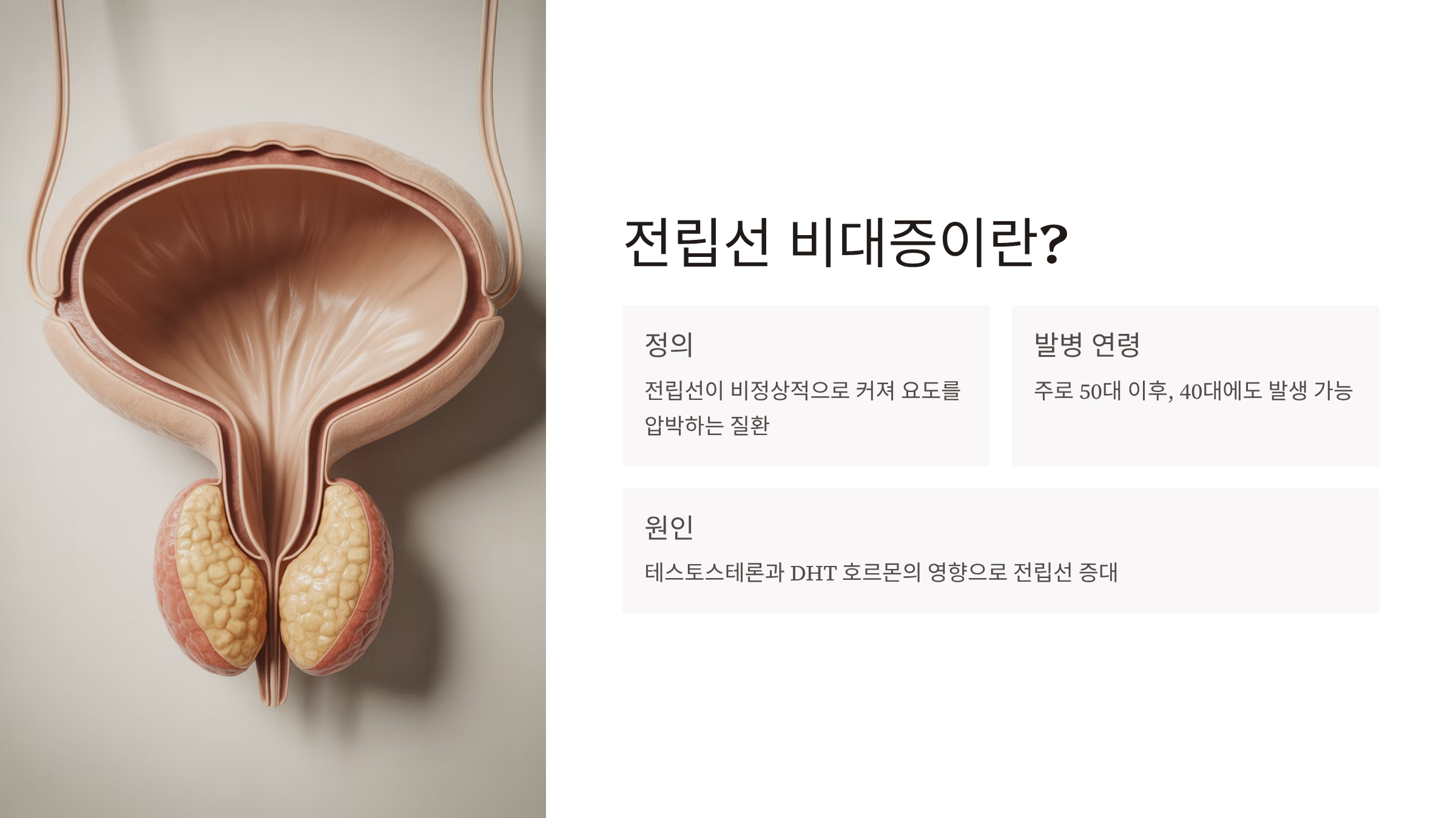 전립선 비대증 증상 치료약 수술비용