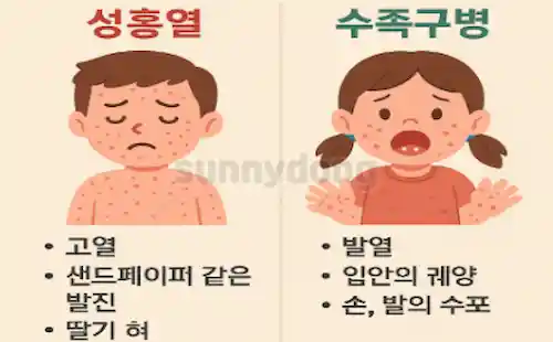 성홍열과 수족구병 증상 차이