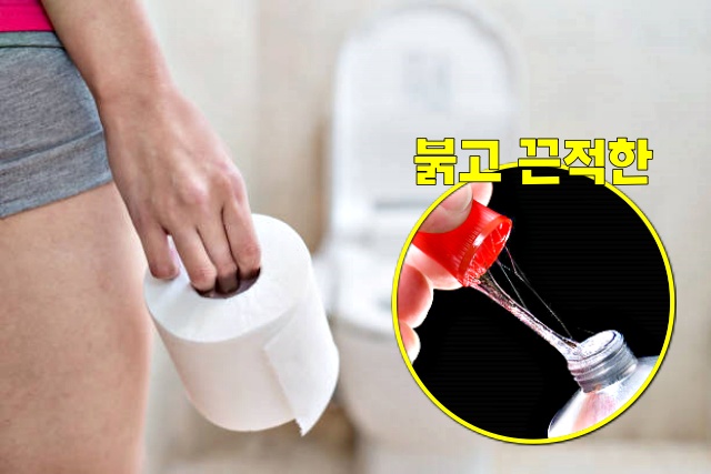 대장암 초기증상, 끈적한 점액질 변,대장암 증상, 건강 팁줌 매일꿀정보