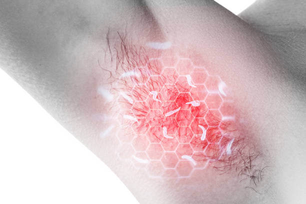 겨드랑이 멍울, 통증 원인 및 예방법입니다. 멍울로 인한 통증과 불편함은 상당히 심각한 문제일 수 있습니다. 하지만 걱정하지 마세요. 이 글에서는 겨드랑이 멍울의 원인과 예방법, 그리고 치료 방법을 알려드리겠습니다. 이제부터 멍울 걱정은 이제 그만! 겨드랑이 건강을 지켜보세요.