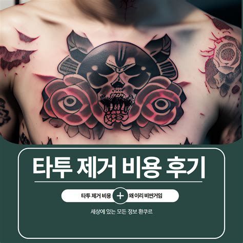 타투 지우는 비용