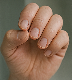 당뇨병 초기증상