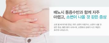 방광염의 약에 대한 효능과 주의할 점