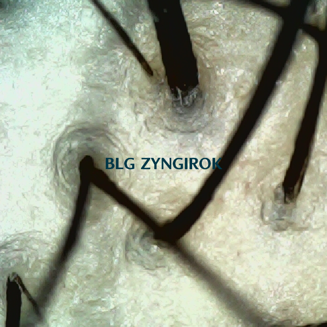 탈모 극복 프로젝트 - 정수리 두피 모습이다.