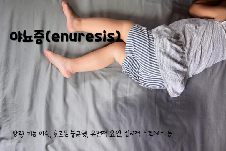 야뇨증(enuresis)
야뇨증 주요 원인 : 방광 기능 미숙, 호르몬 불균형, 유전적 요인, 심리적 스트레스 등