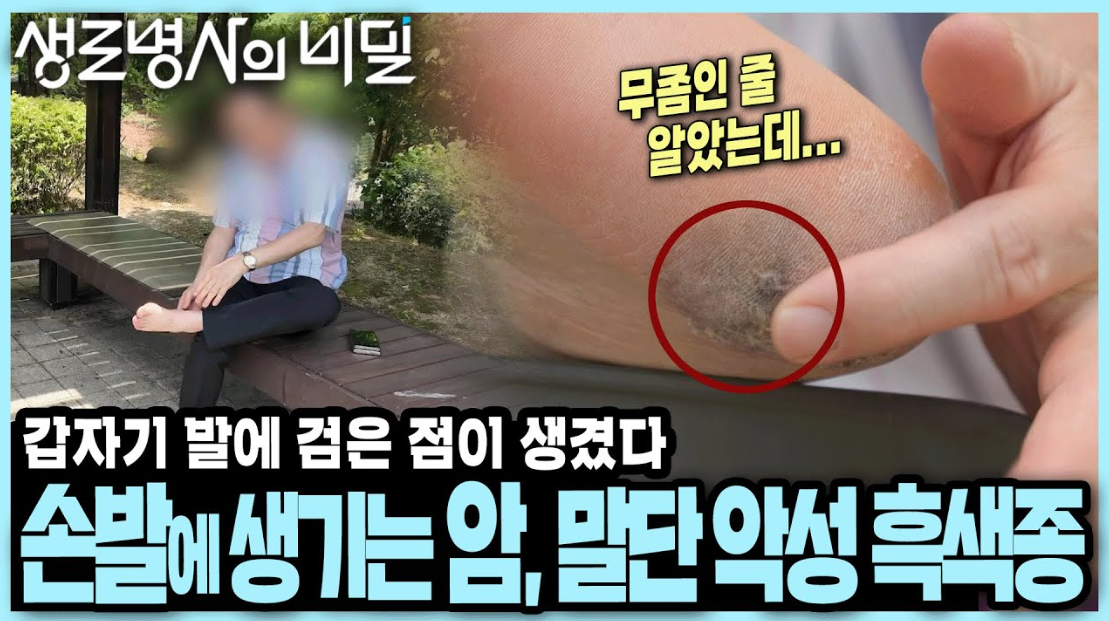 생로 병사의 비밀 악성 흑색종