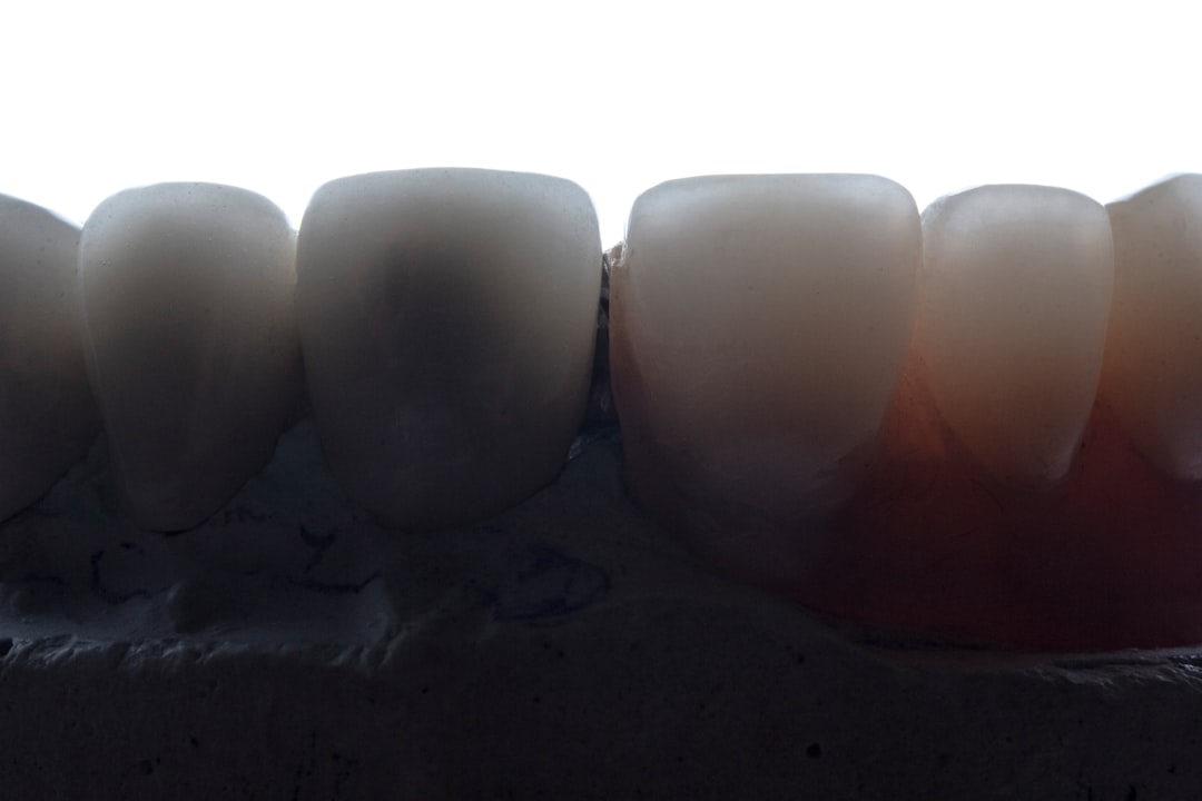 Gums