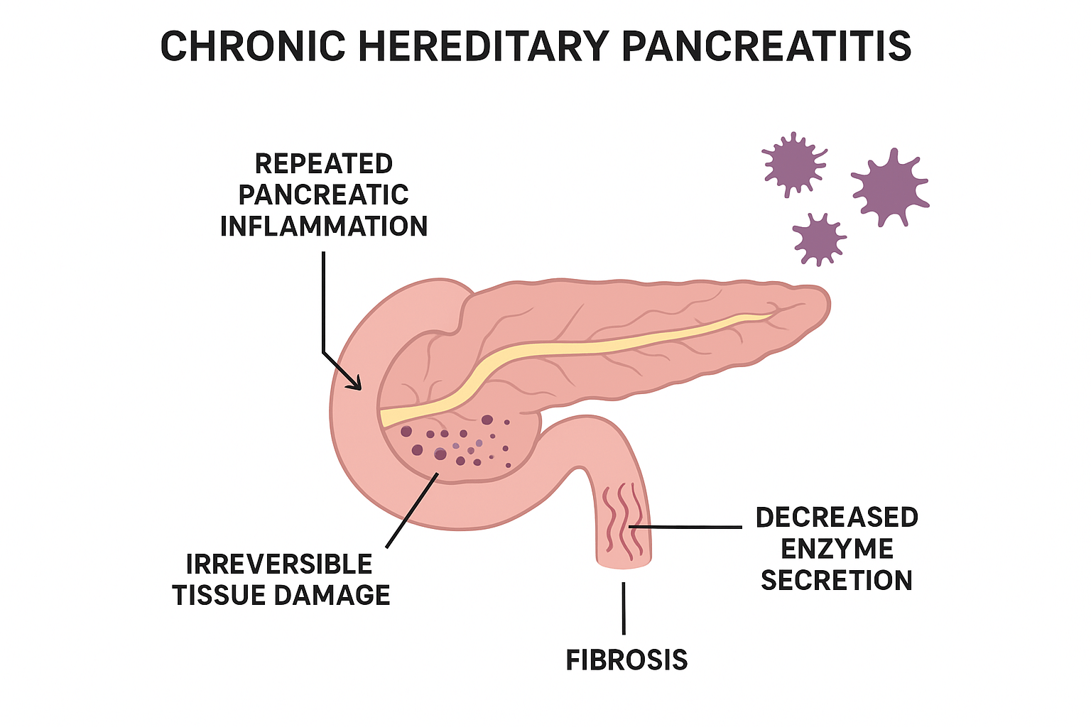 췌장염(만성·유전형)