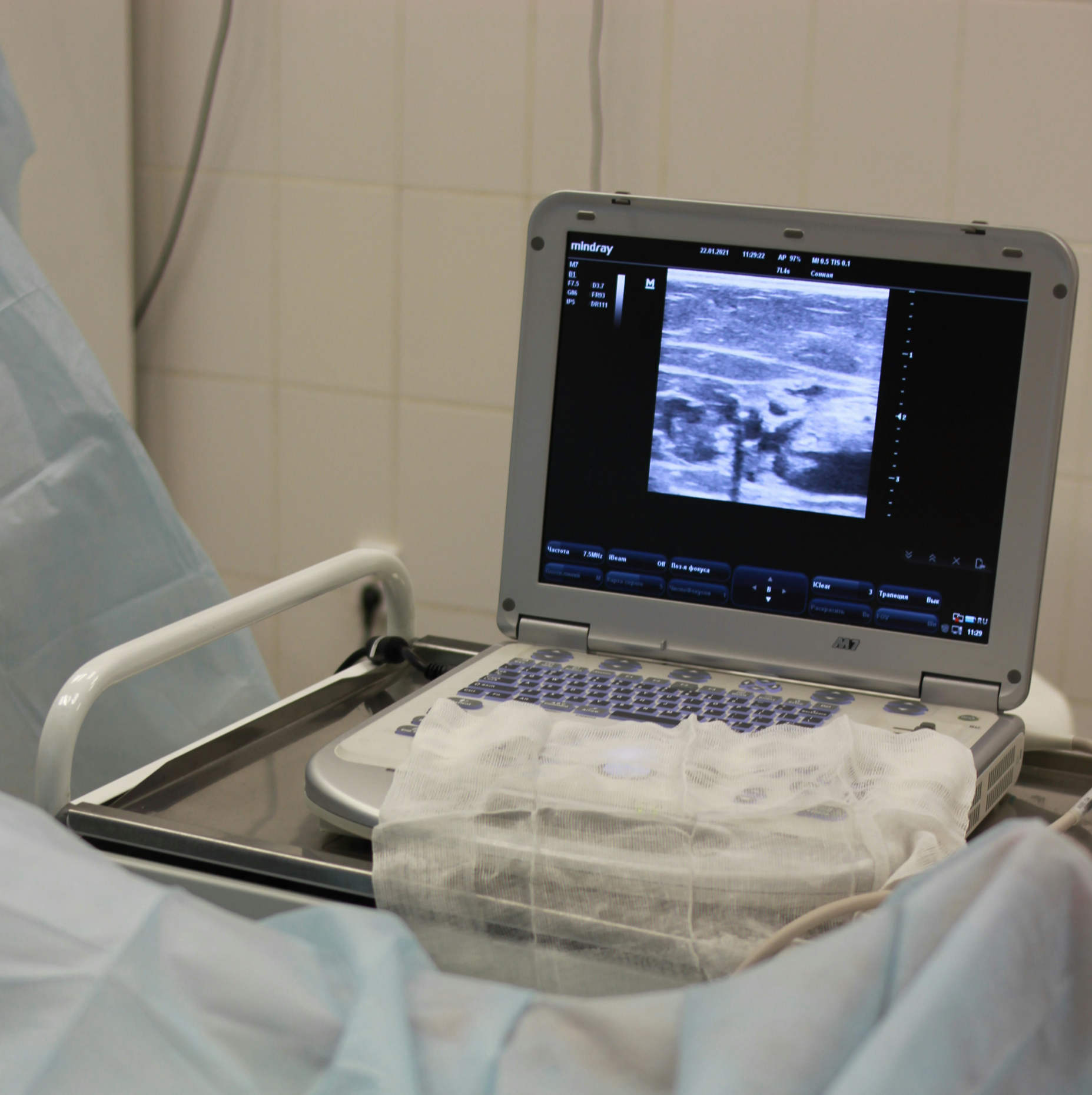 경동맥초음파- 비용과- 실비보험 -청구- 완벽 -가이드- 20253