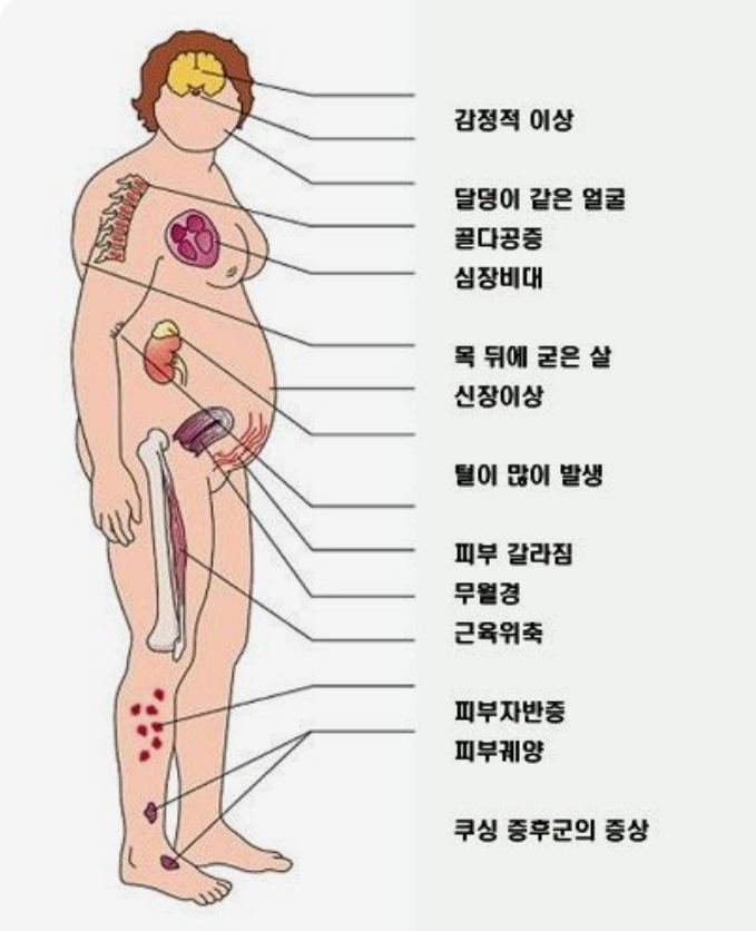 쿠싱증후군-증상-조건