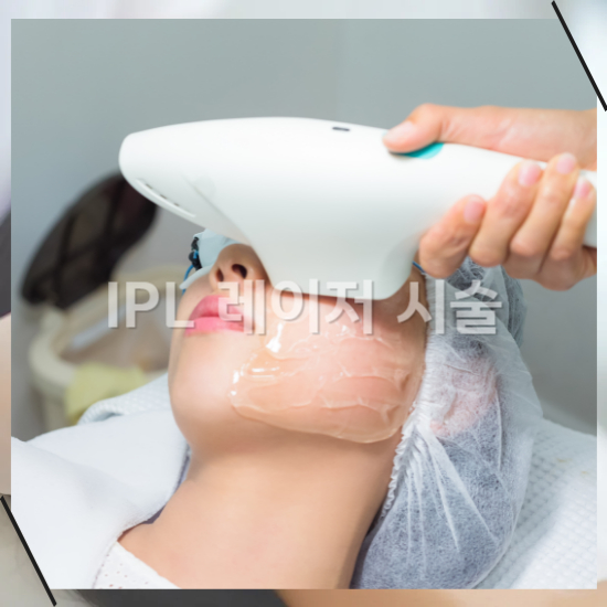 IPL 레이저 시술 가격