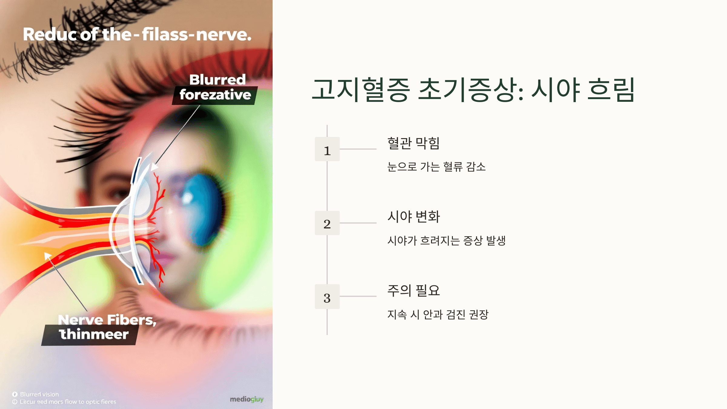 고지혈증과 관련된 사진입니다.