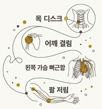 왼쪽 가슴 통증 원인