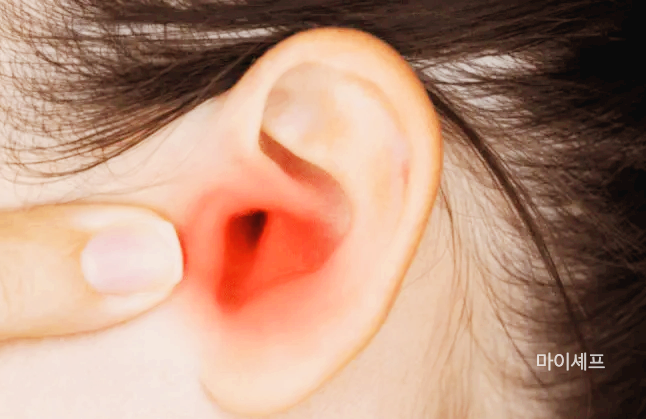 아기 중이염 증상 원인 어린이집 소아 중이염 원인 증상 치료