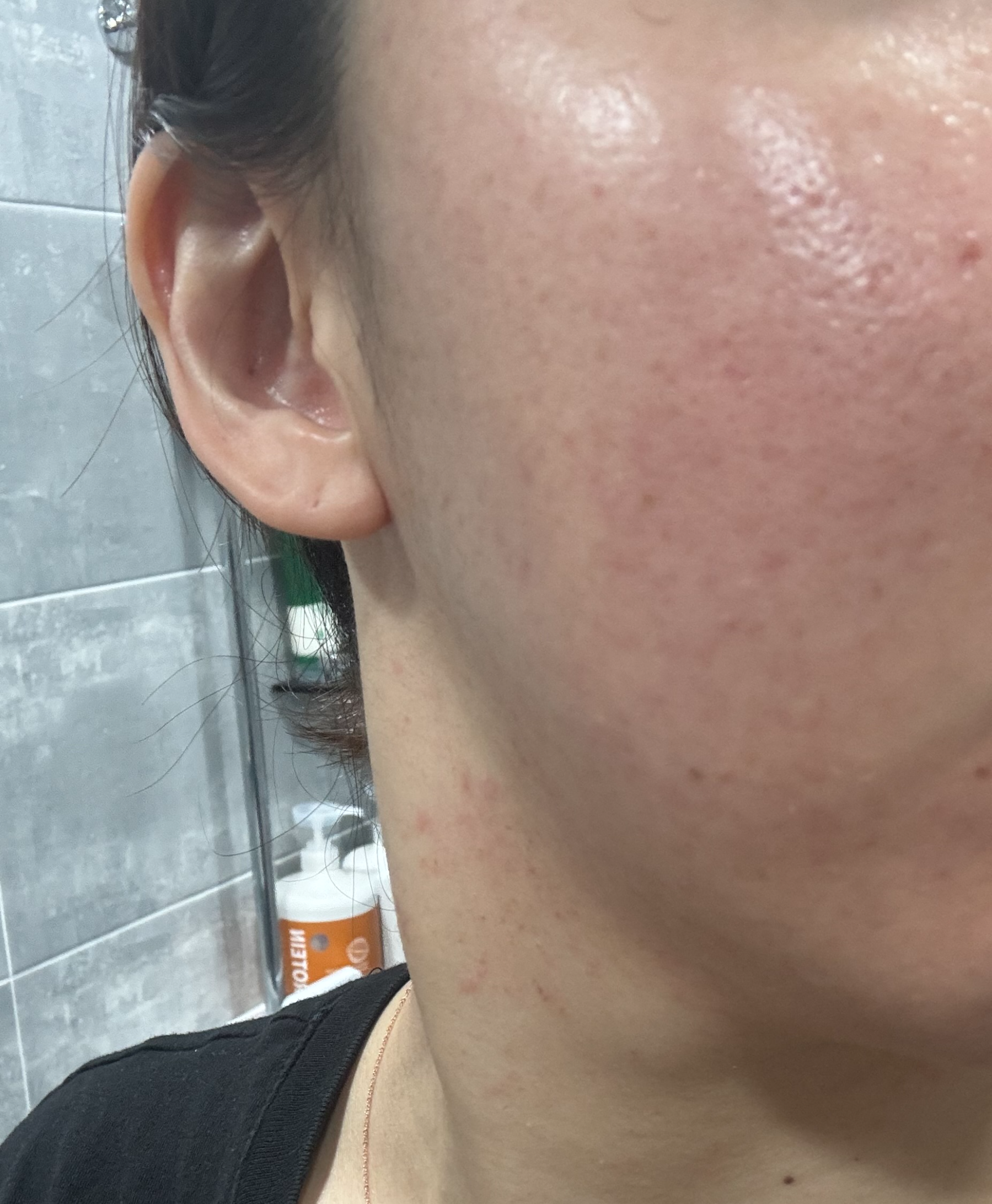 온그리디언츠 로션 -얼굴에 바른사진