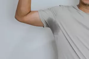 다한증이란