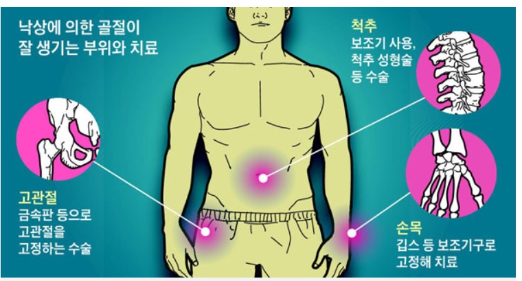 고관절-명의-임승재-교수