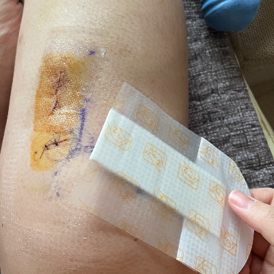 집에서 셀프 드레싱