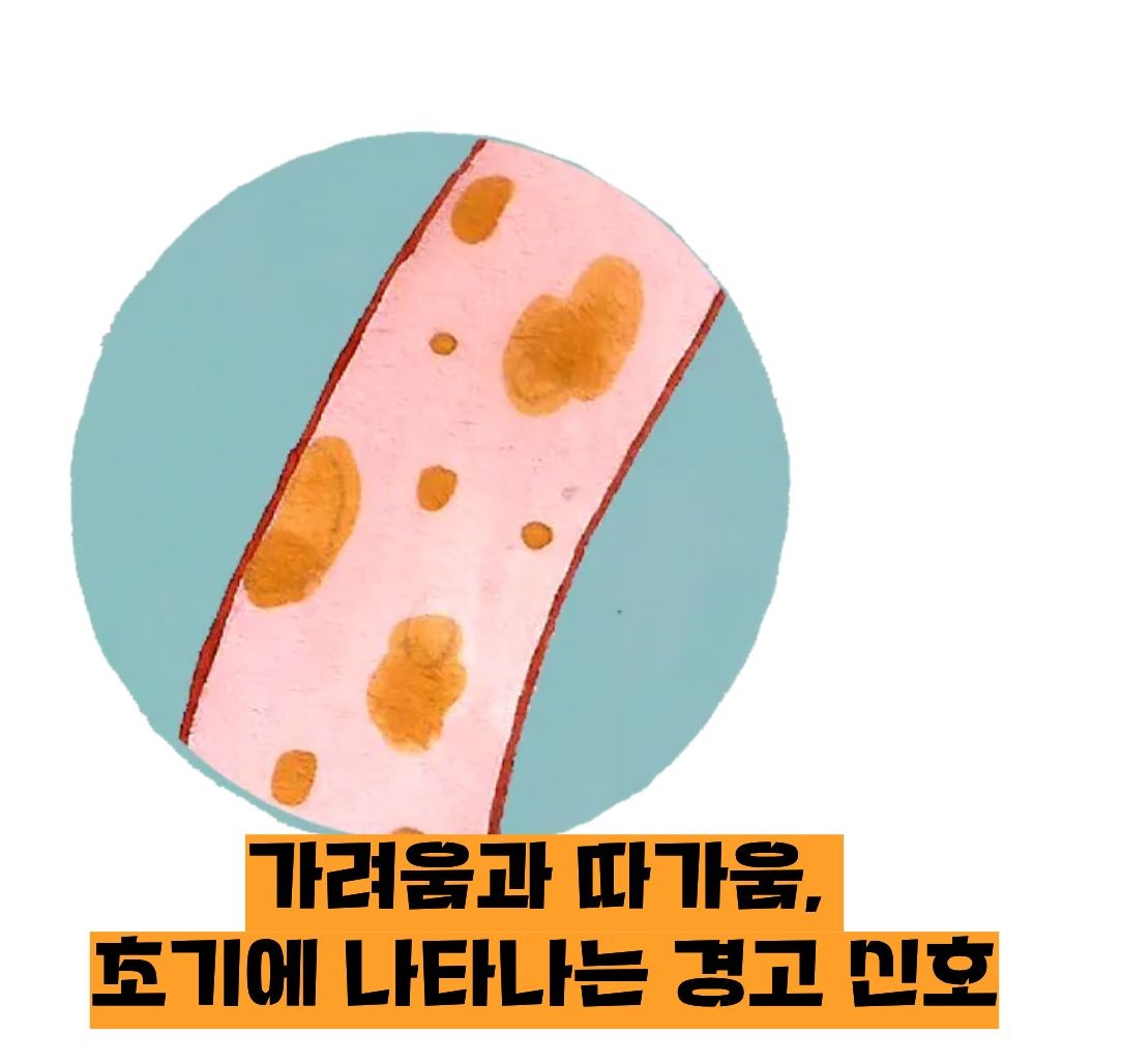 대상포진 초기증상