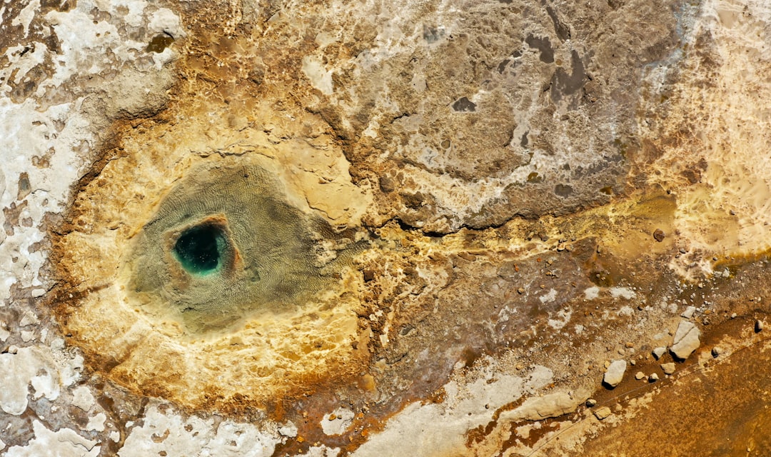 Glaucoma