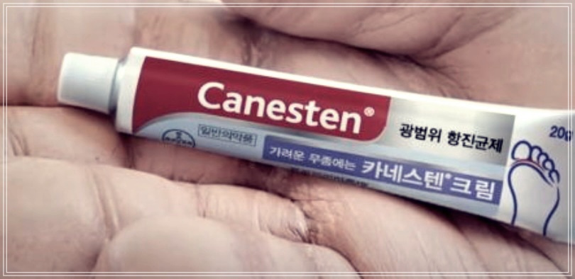 카네스텐 연고 가격 피부 무좀 치료 방법