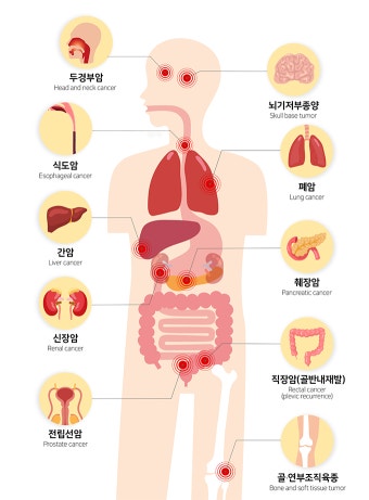 암치료 최전선을 가다: 유전자를 읽고&amp;#44; 맞춤 신약을 처방하는 시대