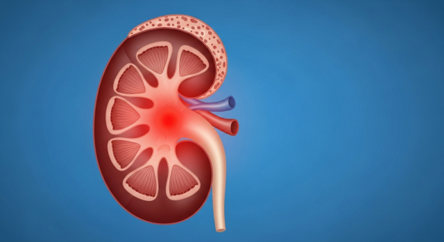 염증으로 붉게 보이는 방광을 강조한 방광염 개념 일러스트