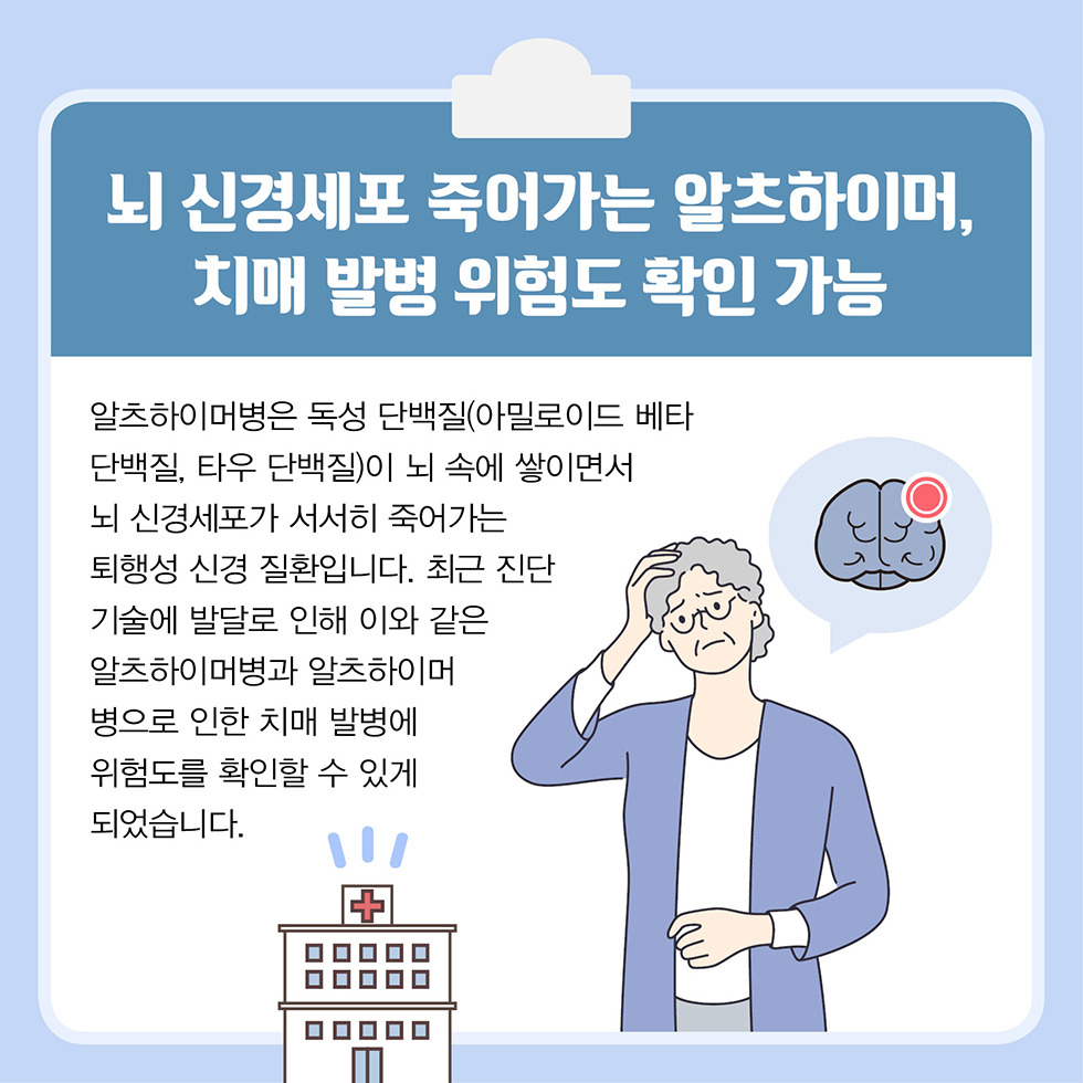 alt="알츠하이머병"
