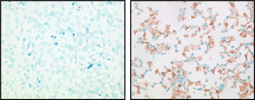 TUNEL assay (statining) 예시