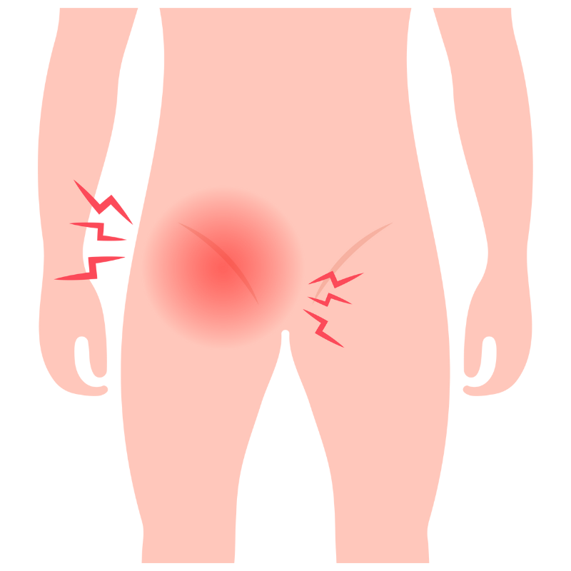 사타구니 탈장 원인 증상 치료법 알아보자