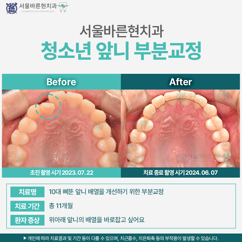 부산청소년교정