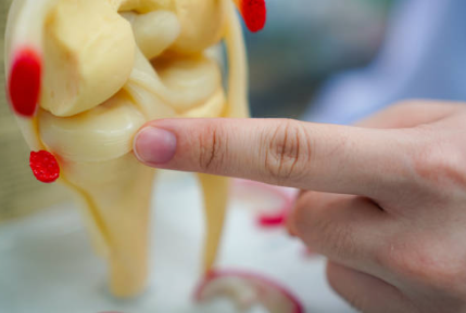 퇴행성 반월상 연골 파열