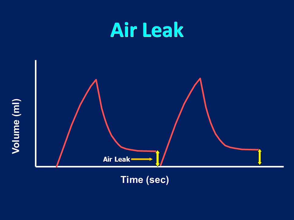 ventilator air leakage